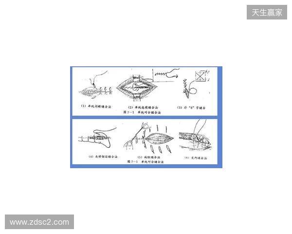 广州豹官方:杨浩眉弓伤口缝合30余针,预计5-7天后拆线 广州豹官方:杨浩眉弓伤口缝合30余针,预计5-7天后拆线